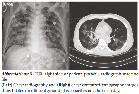 Ccot Radiographic EXPERIMENTAL AND CLINICAL TRANSPLANTATION